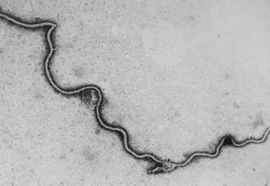 Borrelia Burgdorferi isolated from liquor Borrelia Burgdorferi isolated from liquor